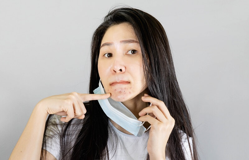 Xây dựng lối sống lành mạnh để mụn do nội tiết tố không còn cơ hội mọc