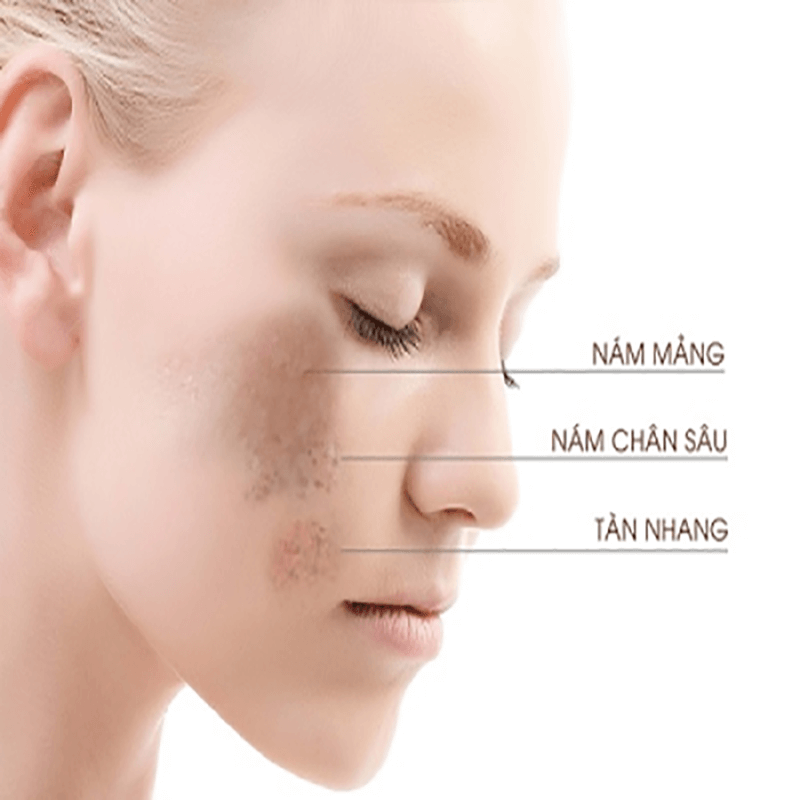 Cách phục hồi da yếu, hư tổn