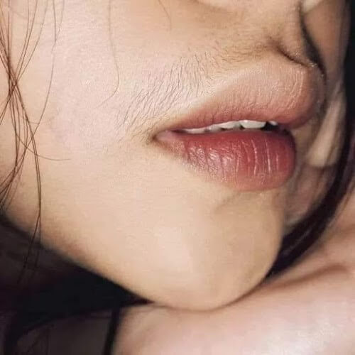 Triệt Ria Mép Vĩnh Viễn