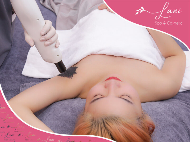 Điều trị thâm nách - thâm mông