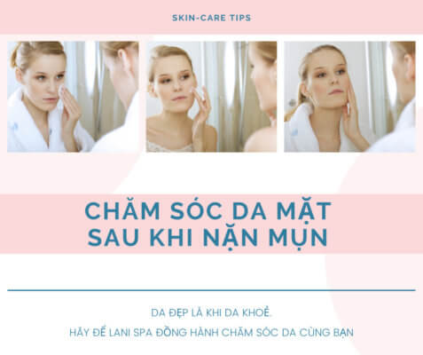 Chăm sóc da mặt sau khi nặn mụn